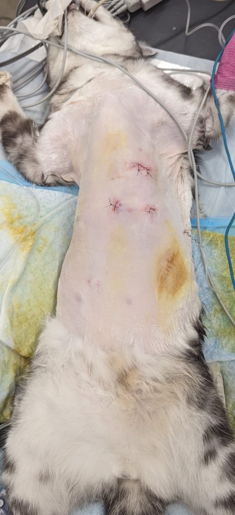 胸腔鏡下前縦隔腫物切除