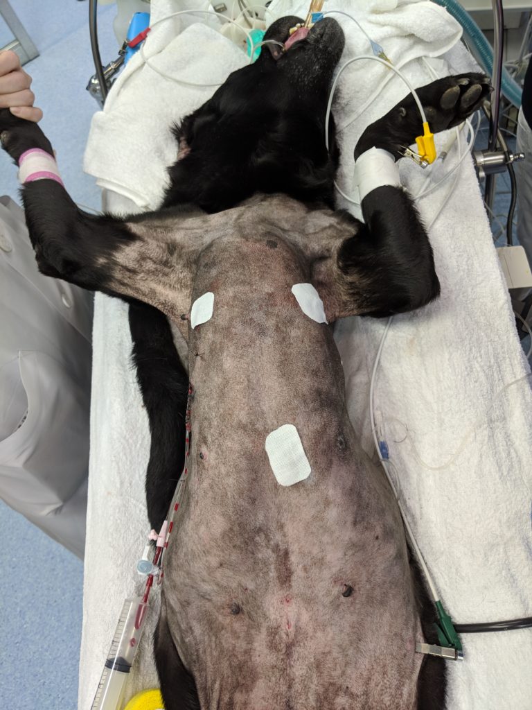 胸腔鏡下前縦隔腫物切除