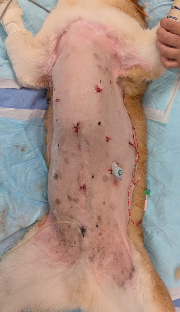 胸腔鏡下胸腔内探査、組織生検