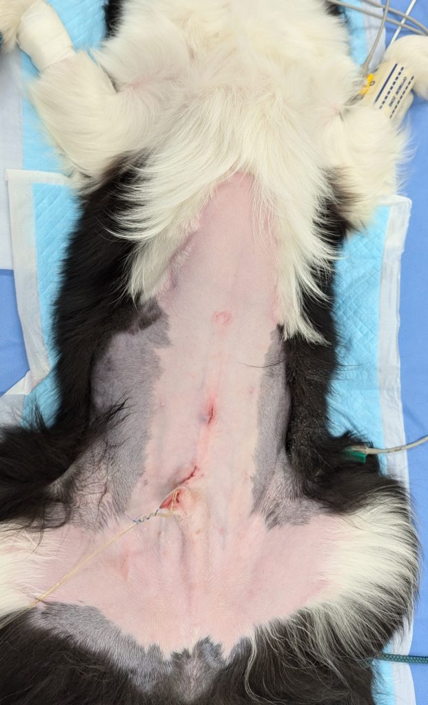 腹腔鏡下（補助下）停留精巣摘出