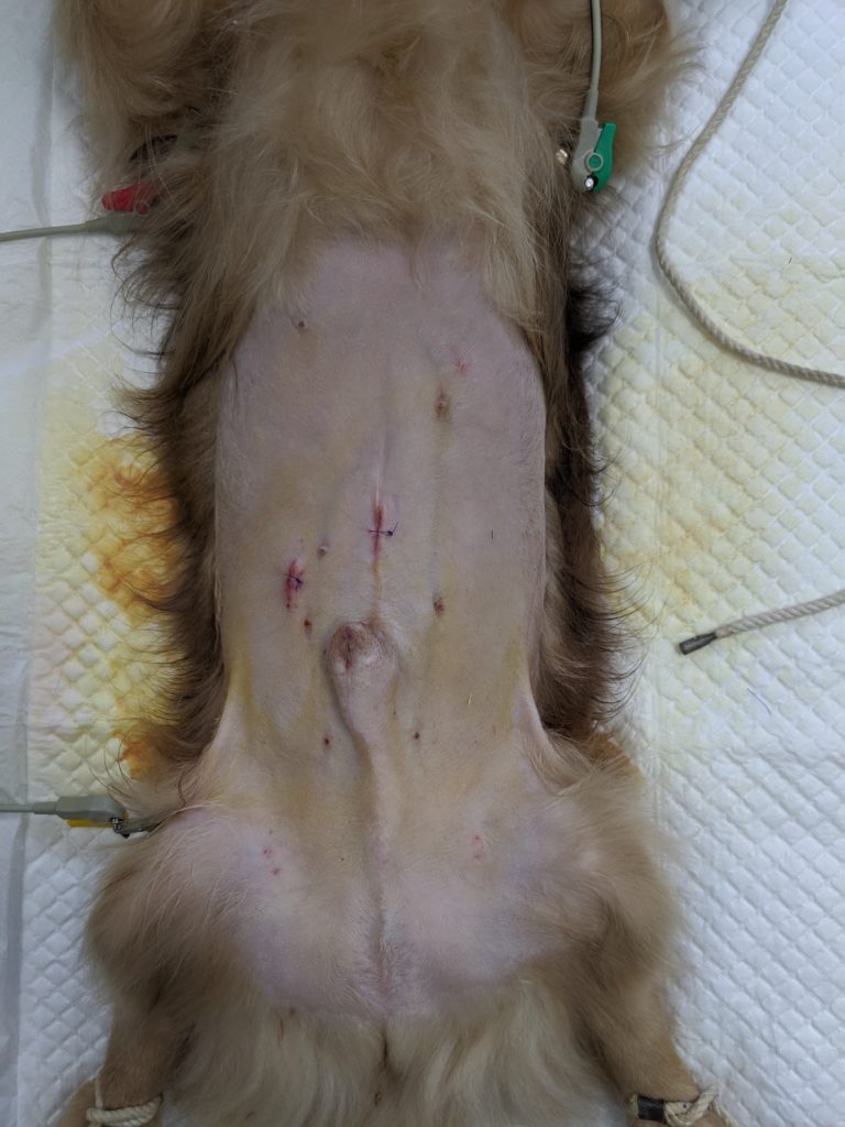 腹腔内組織生検