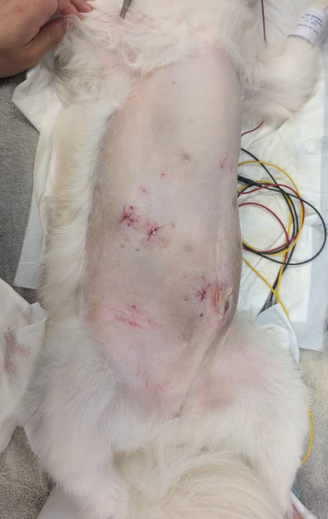 腹腔内組織生検