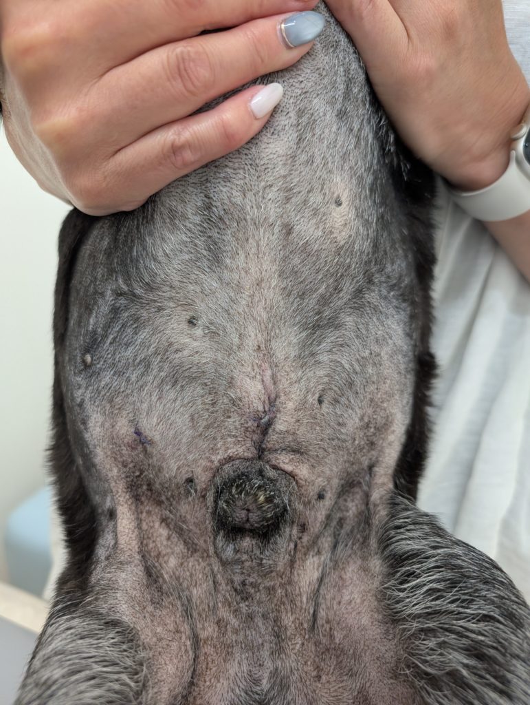 腹腔内組織生検