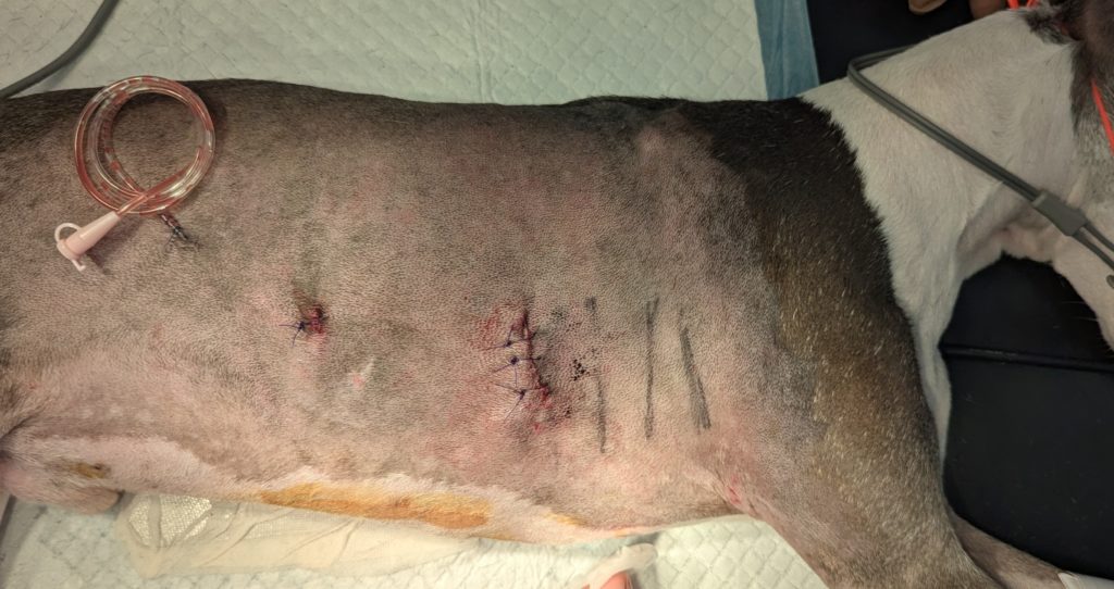 胸腔鏡下（補助下）肺葉切除