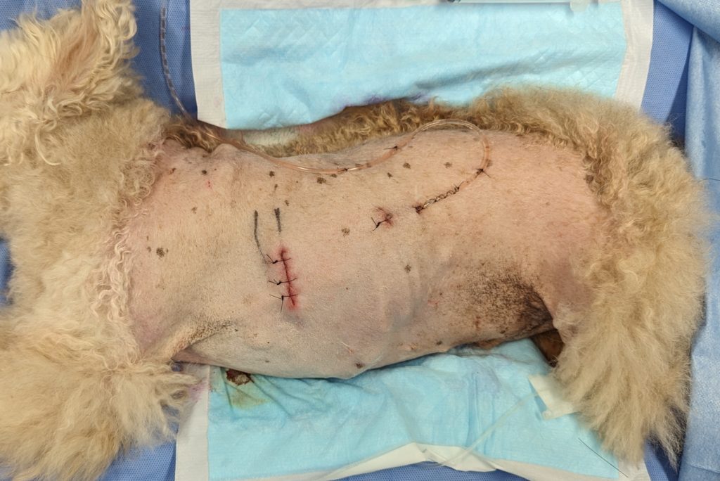 胸腔鏡下（補助下）肺葉切除