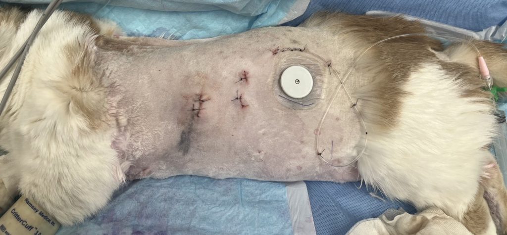 胸腔鏡下（補助下）肺葉切除