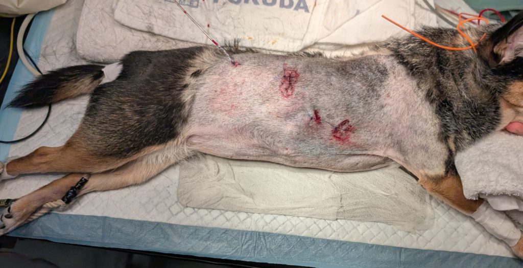 胸腔鏡下（補助下）肺葉切除